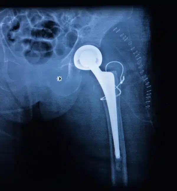 medicus-19-1 flebolog