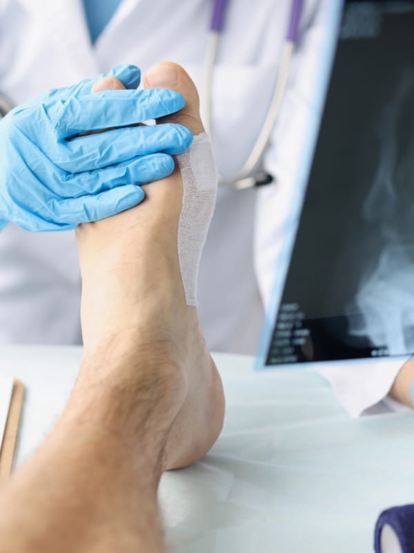 Chirurgia stopy (3) flebolog