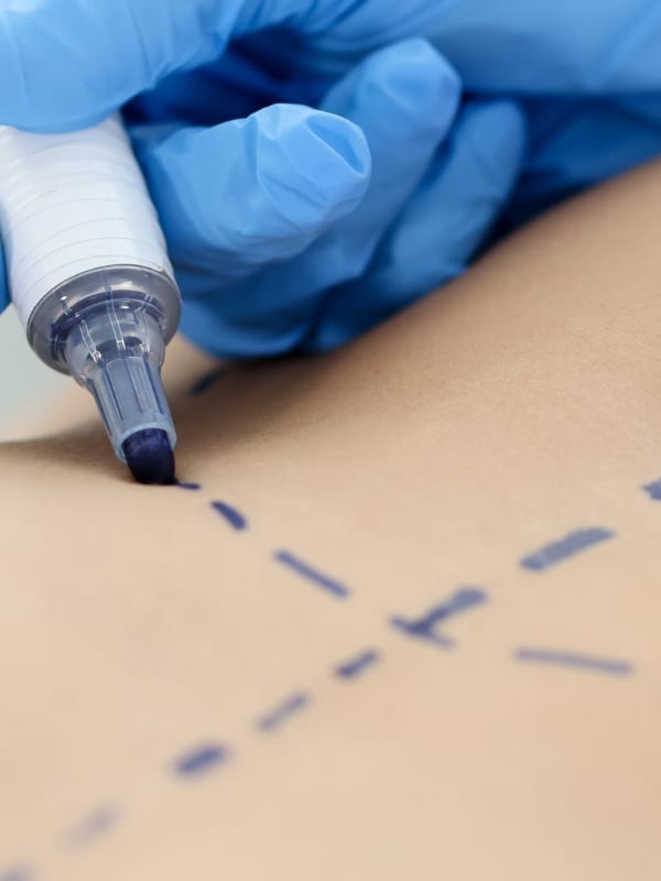 Plastyka brzucha – Poznań (2) flebolog