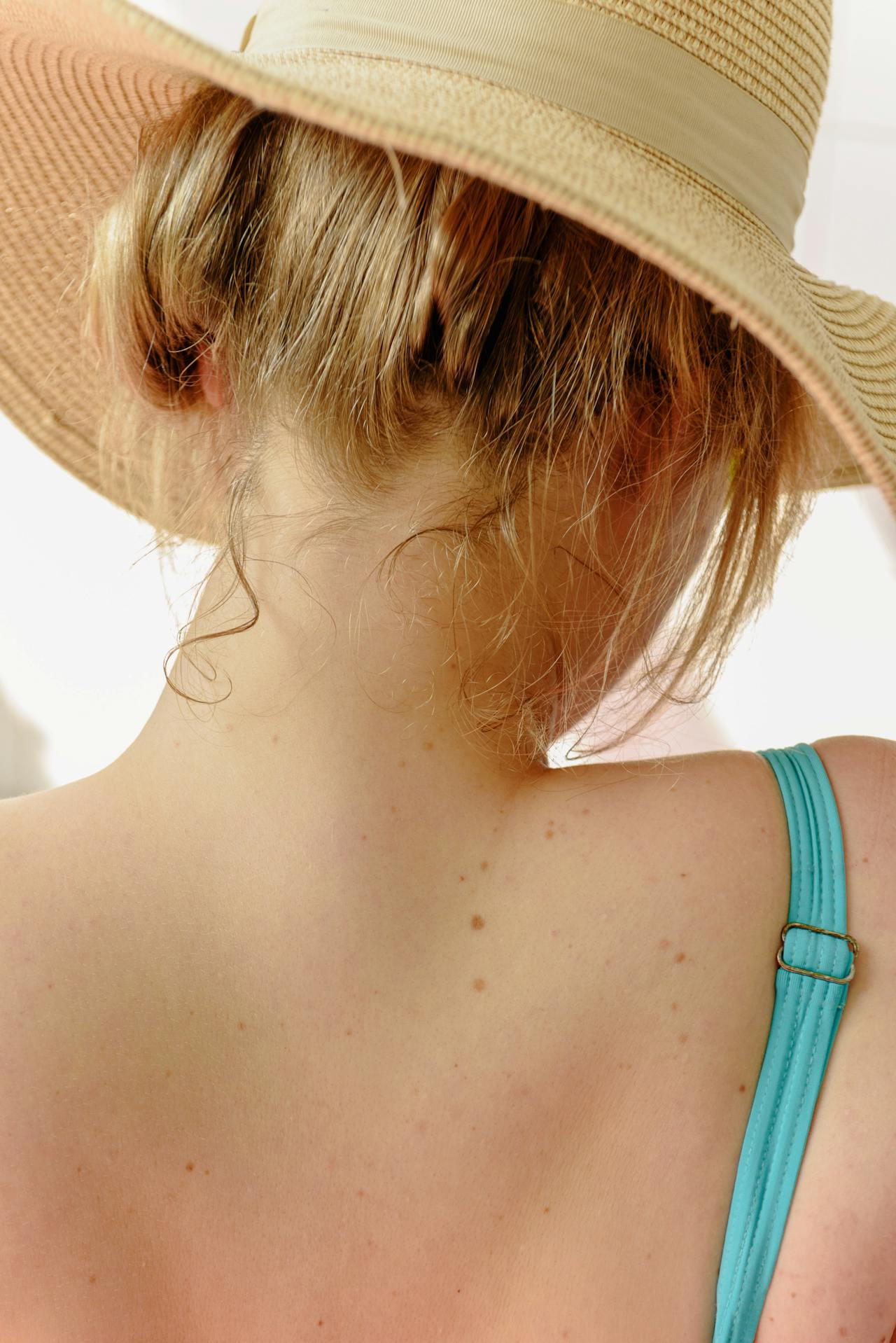 Dermatoskopia – ocena pieprzyków rakowych przez dermatologa
